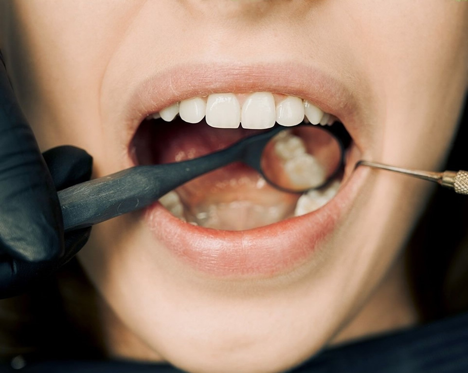 dental crown and bridge treatment at care and cure dental clinic dombivli